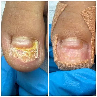 Podologia Viktoria Zaiats - Centrum Zdrowia Stóp